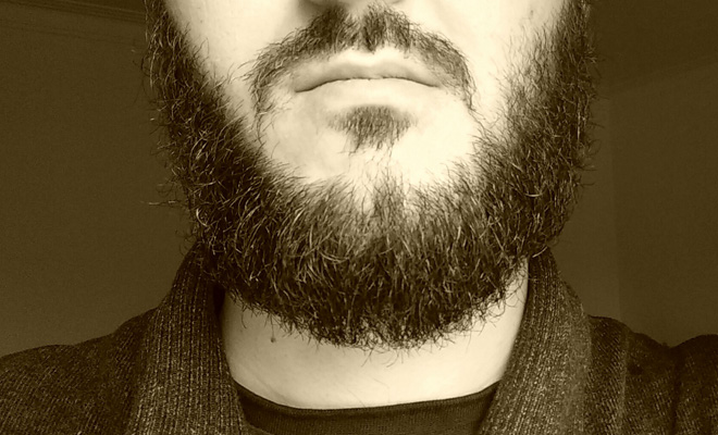 Beard-Transplant